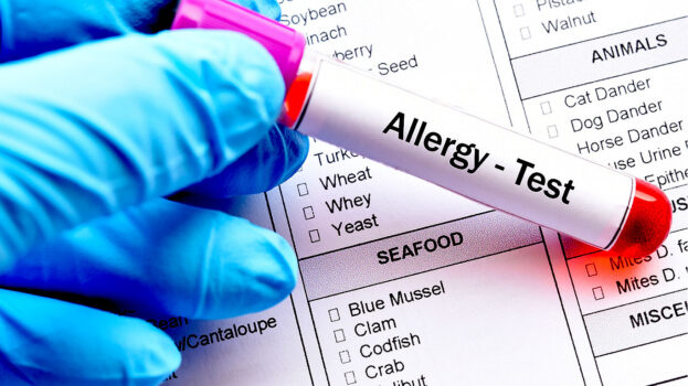 Basic Food Allergy test