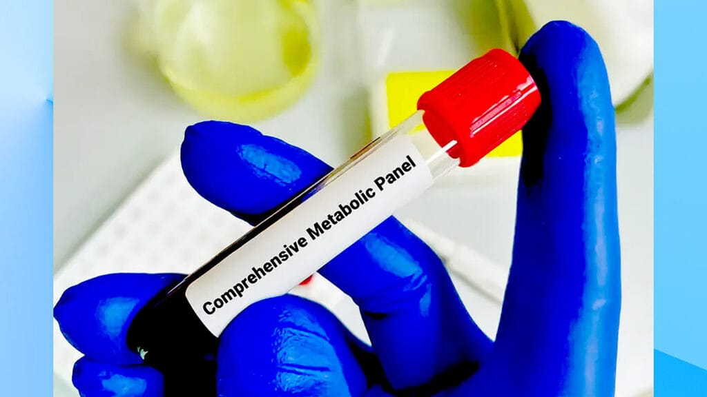 Comprehensive Metabolic Panel