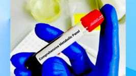 Comprehensive Metabolic Panel