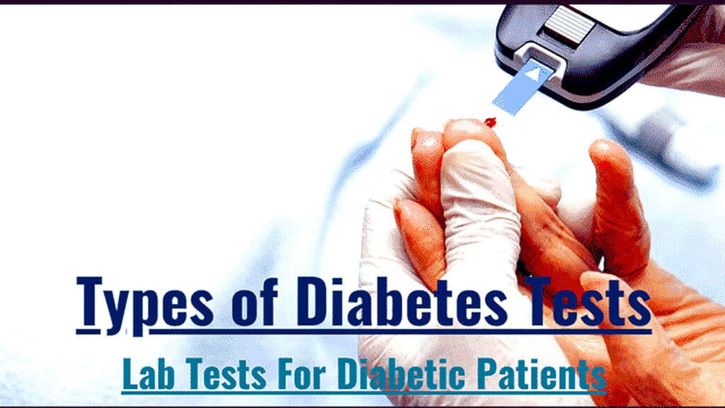 diabetes test