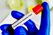 Comprehensive Metabolic Panel (CMP) Popular