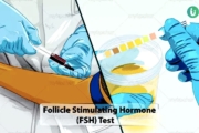 Fertility & Pregnancy Testing: Follicle Stimulating Hormone (FSH) Test